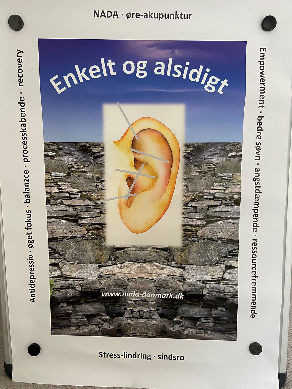 NADA- øreakupunktur