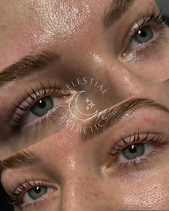 brow lamination