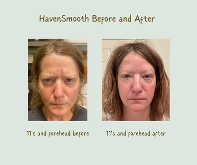 HavenSmooth FH before and after.png