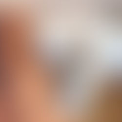 Tudo sobre a Pseudociese!