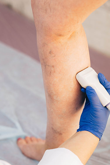 medical-ultrasound-examination-of-leg-veins-in-hos-2026-03-25-05-53-28-utc.jpg