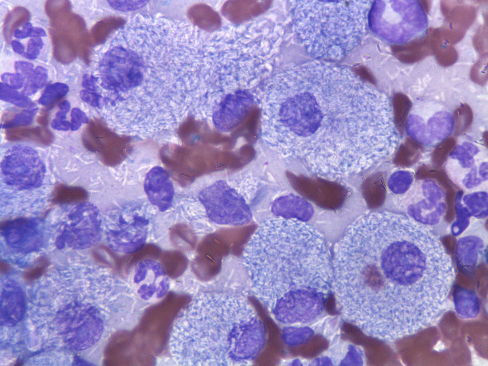 349849-1-SPLEEN2.jpg