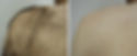 Laser Treatments , Non-invasive, Greenwich, Connecticut. Greenwich, CT