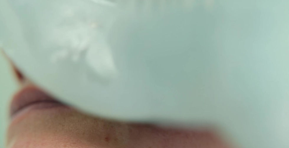 Fotona 4D Facelift, laser treatment, best med spa greenwich ct