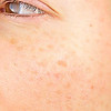 sunspots.jpg