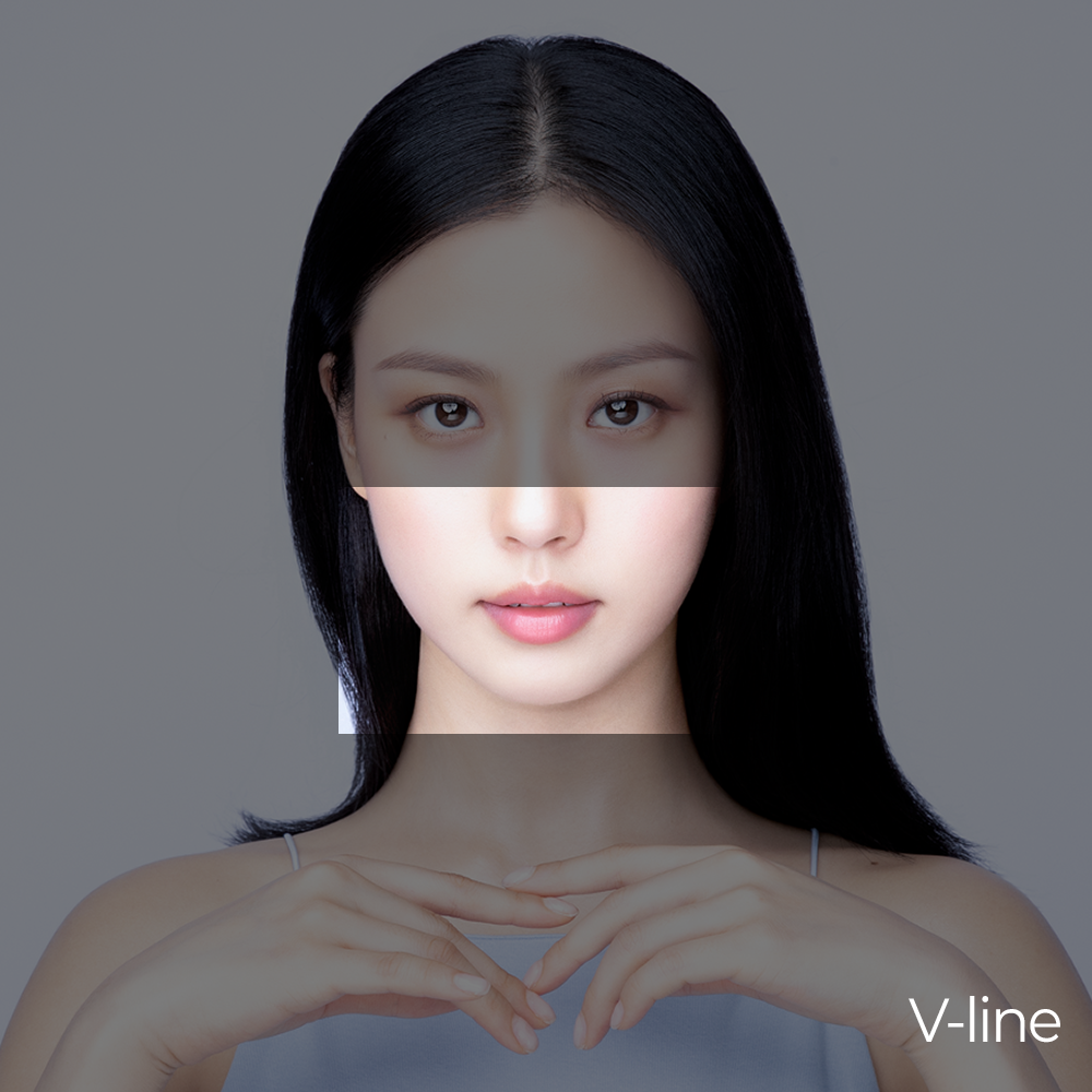 Ultraformer MPT V-Line Lifting (Jawline Lift)