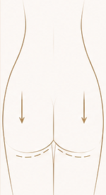 03-01.png