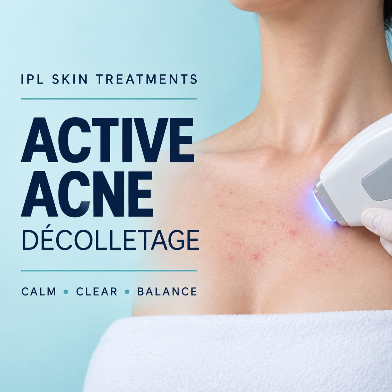 IPL Active Acne Décolletage