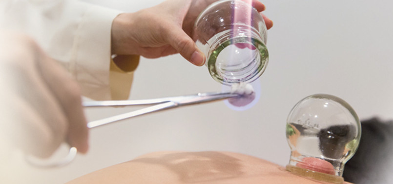 cupping.jpg