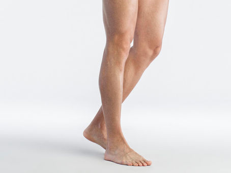 Calf Reduction in Dubai