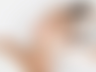 Volift Fillers in Dubai 