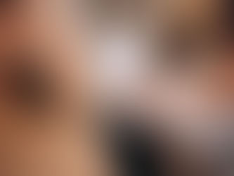 Can Laser Hair Removal Remove Facial Hair?