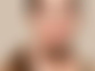 Facial Contouring in Dubai