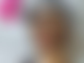 Laser carbon peel in Dubai