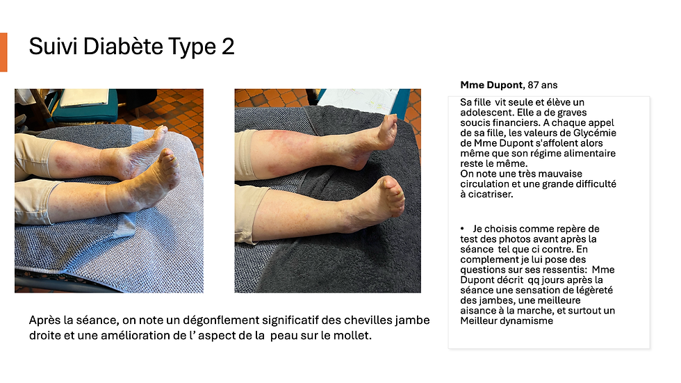 Suivi Diabete type 2 - senior