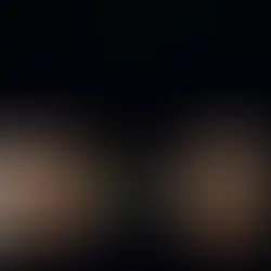 Absenteeism in SMEs: how to reduce costs through prevention and insurance