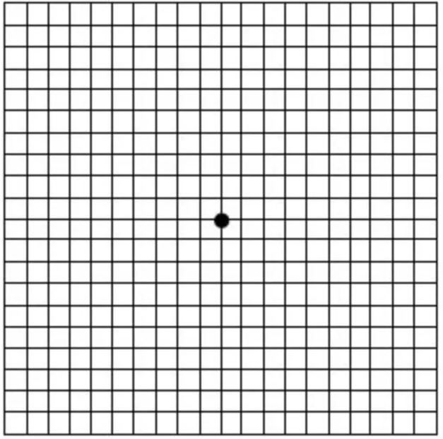 Macular Degeneration