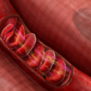 chromium deficiency symptoms chromium deficiency symptoms