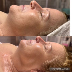Custom facial with improved complexion, even skin tone and hydrated skin.