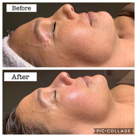 Custom facial with improved complexion, even skin tone and hydrated skin.