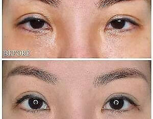 Skin Tightening Treatment Offers In Singapore - Beautyrecipe 