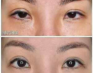 Skin Tightening Treatment Offers In Singapore - Beautyrecipe 