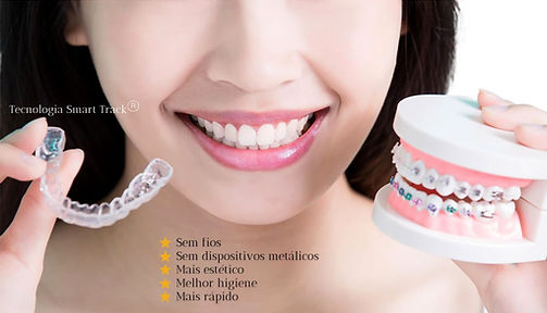 Benefícios do Invisilign Ortodontia moderna Bauru