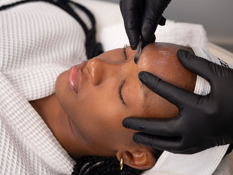 Dermaplaning: What It Is, Its Benefits, and the Truth About Hair Growth