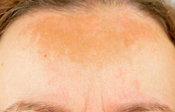 BEHIND THE BROWN SPOT 