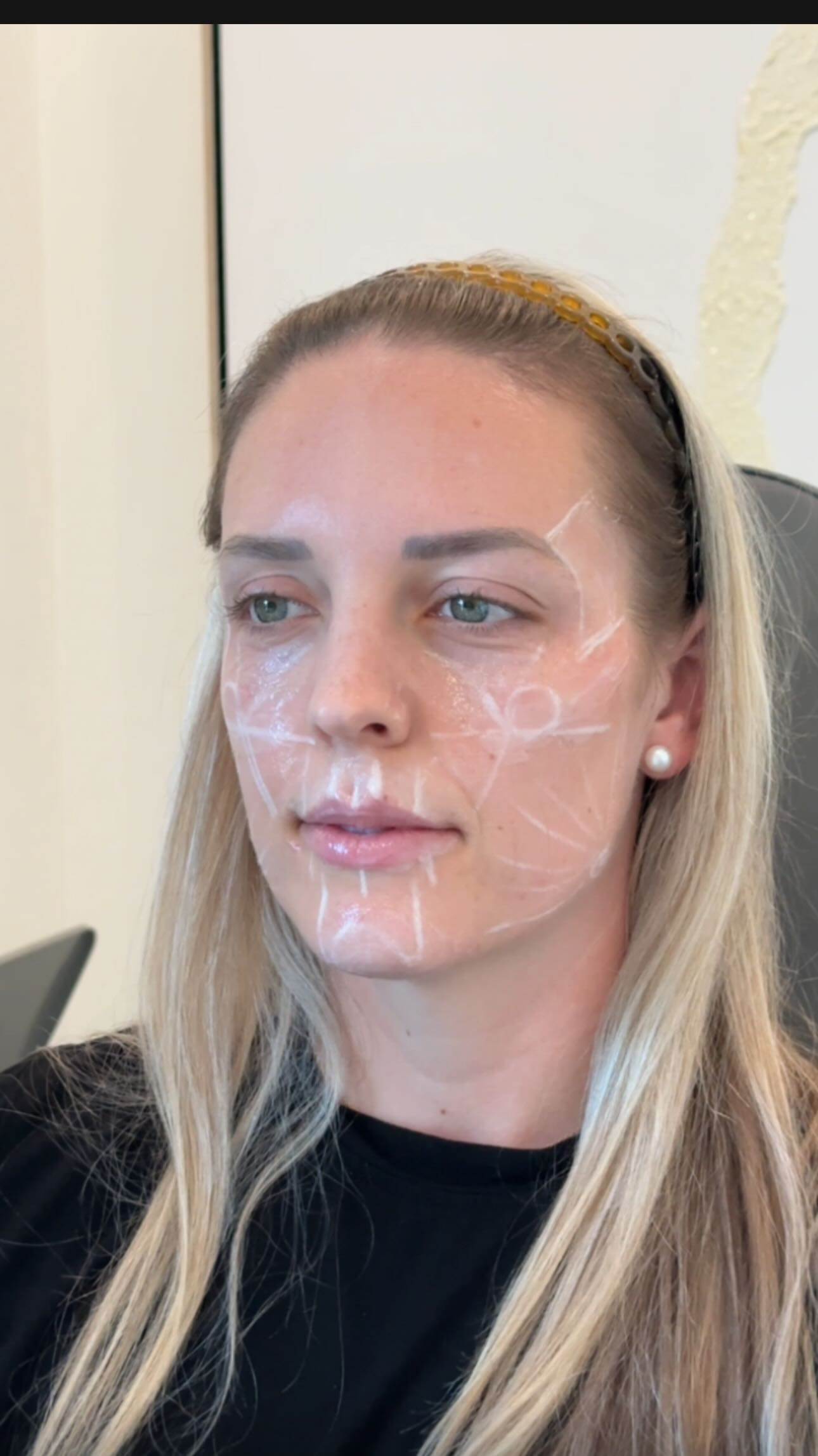 Face mapping during skincare consult at Slim Studio Buckhead