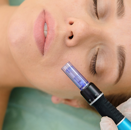 Close-up of esthetician using a HydraFacial device on a client’s cheek.