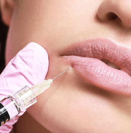 Syringe applying filler to pink lips.