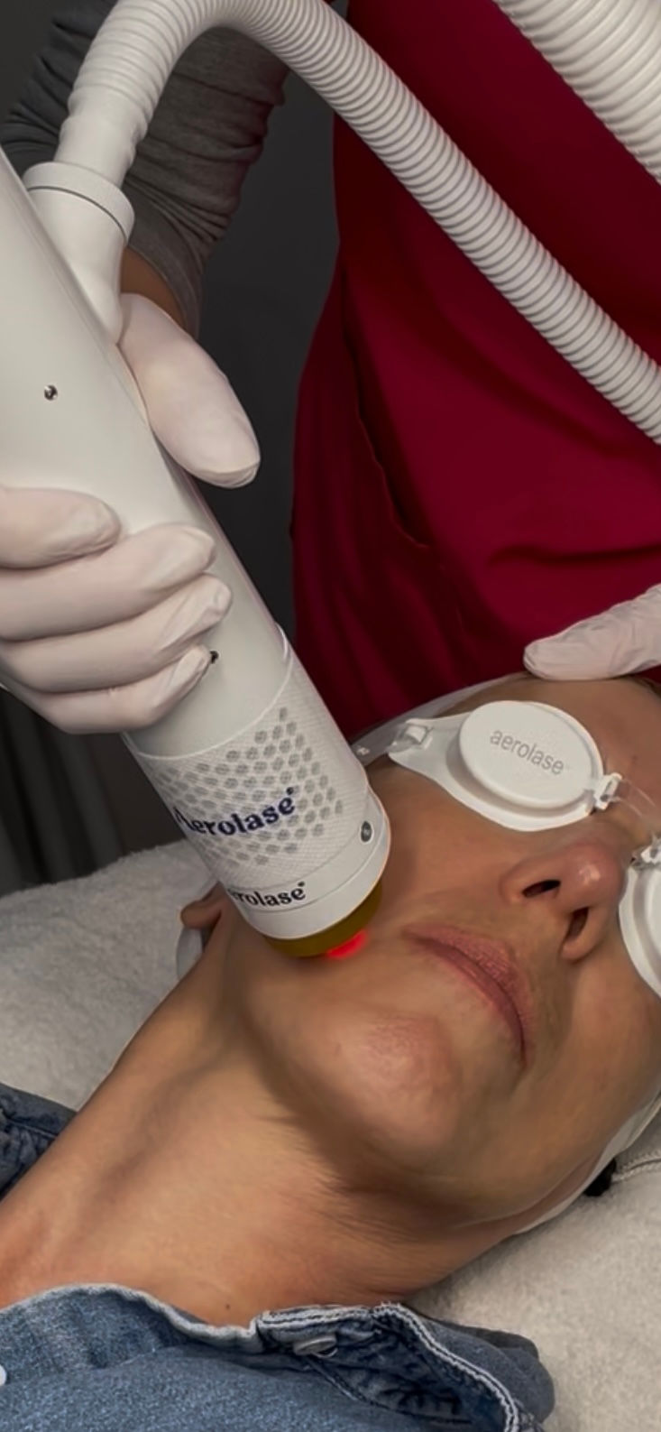Aerolase Neo Elite - laser skin rejuvenation Northville MI