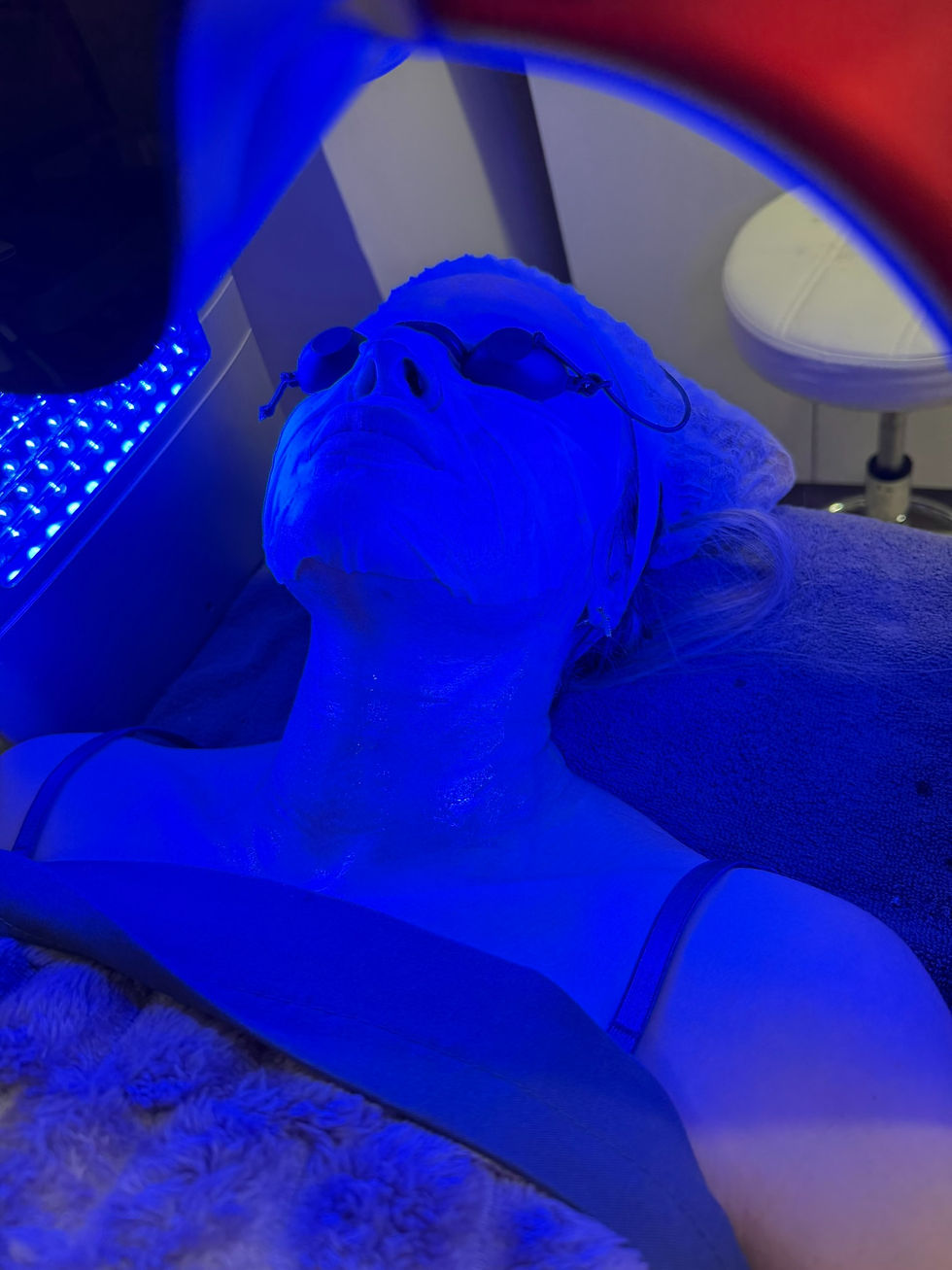 Close-up view of microneedling device on skin surface