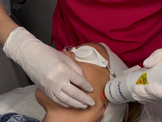 Aerolase Skin rejuvenation