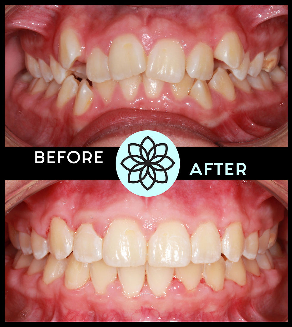 The Bloom Orthodontics team specializing in customized braces and Invisalign® treatment - Parker, Lone Tree, Highlands Ranch