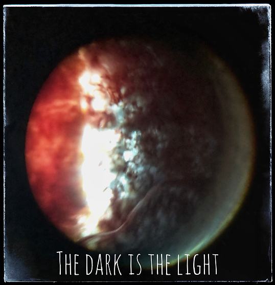 The Dark is the Light.png