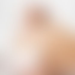 คุณแม่ตั้งครรภ์ ดูแลผิวอย่างไรไม่ให้แตกลาย