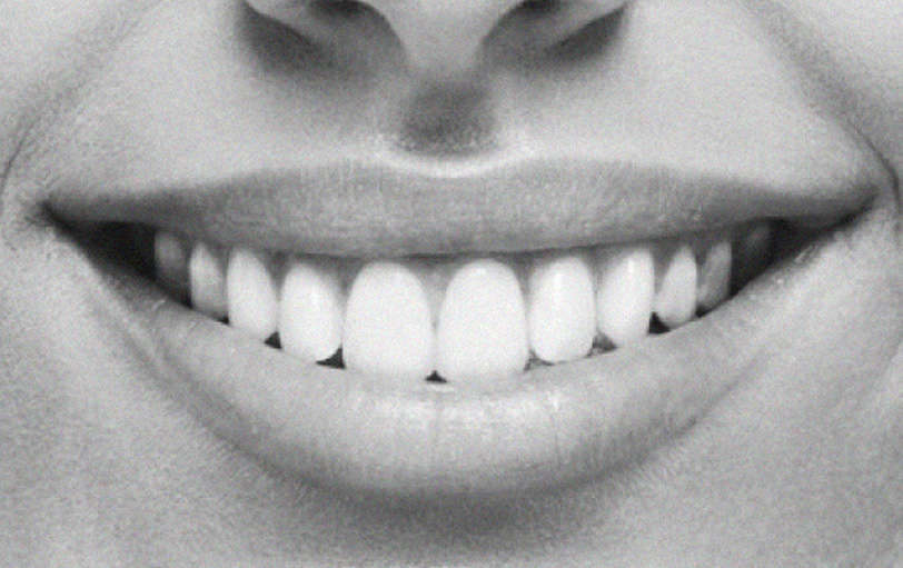 Smile 02.jpg