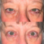 ree