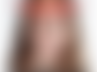 Botox, Exercise and Skincare: How Millennials are looking younger and slowing down aging more than a