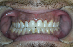 Case 9 - After