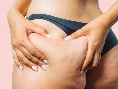 Understanding LED Lipo Cellulite Reduction Treatment