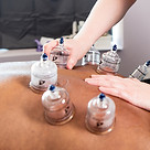 a photo of a Massage Therapist performing cupping therapy on client