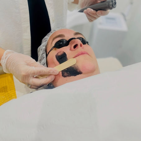 Laser Isn’t a Luxury Anymore — It’s the Standard