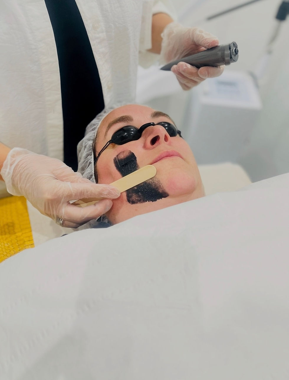Laser Isn’t a Luxury Anymore — It’s the Standard