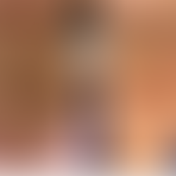 Client’s Neck – Before Treatment Unedited photo of a female client’s neck showing visible signs of Tech Neck, including fine lines and skin laxity before treatment