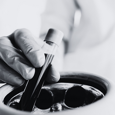 5 Vampire Facial (PRP) Myths That Need Debunking in 2024 and why you should offer this treatment to clients