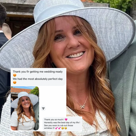 Mary on her sons wedding day after a course of FaceStim at You