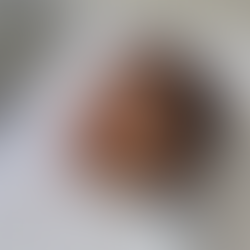 Skin Boosters: What They Really Are (and Why They’re Not All the Same)